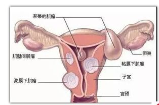 子宮內(nèi)膜增厚是什么意思,子宮內(nèi)膜增厚，定義、原因與應(yīng)對的精準解答,全面應(yīng)用分析數(shù)據(jù)_凸版印刷48.58.36