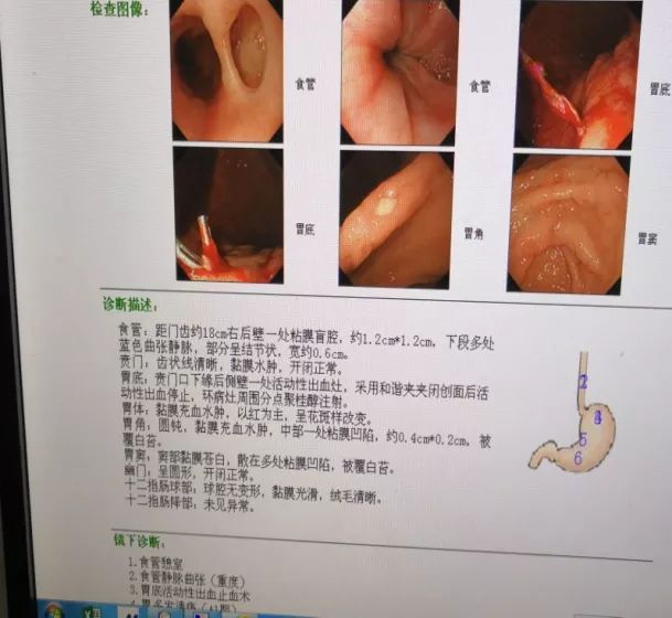 溴門王中王一港澳王中王,指甲出現黑線是癌癥預警？科普