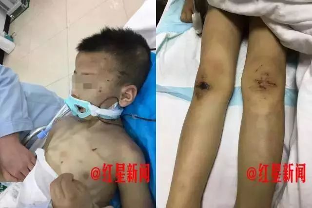 香港最全資料圖庫(kù)正正版版的功能,8歲男孩泡溫泉手指感染HPV現(xiàn)狀說(shuō)明解析_Device48.52.93